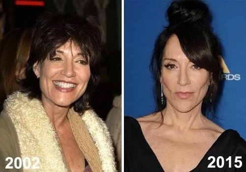 A picture of Katey Sagal before (left) and after (right).
